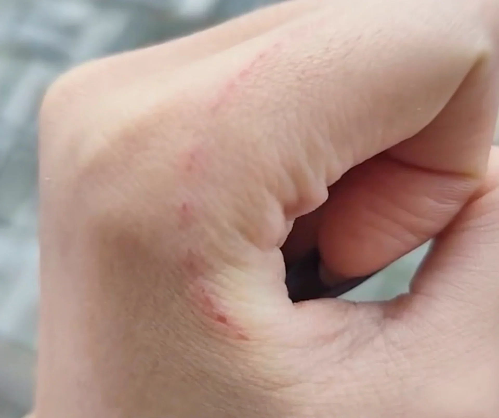 The foolhardy boyfriend saw the wound and immediately tried to suck it clean. Photo: Weibo