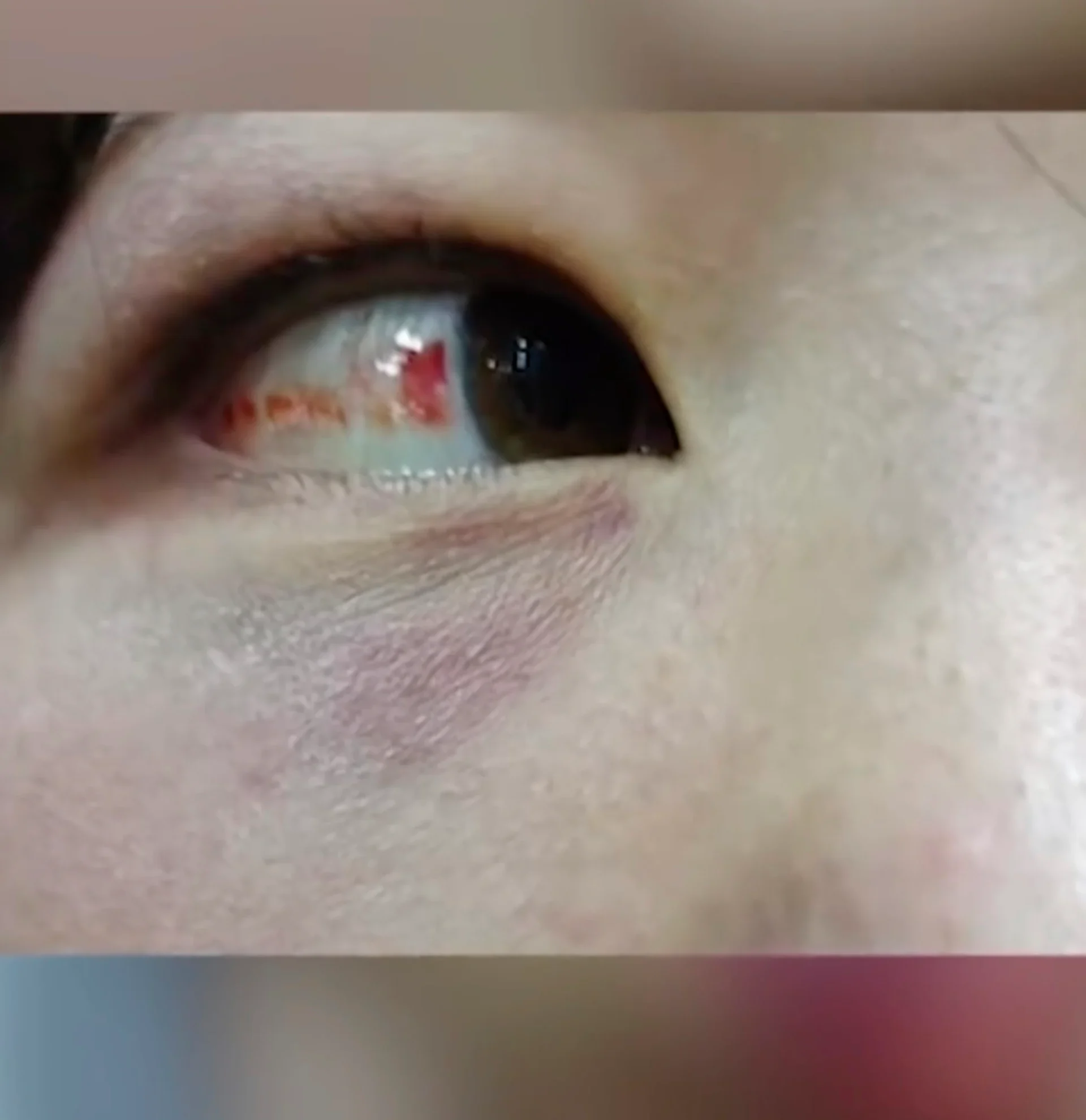 The 14-year-old suffered multiple injuries in the attack, including damage to her eye. Photo: Weibo